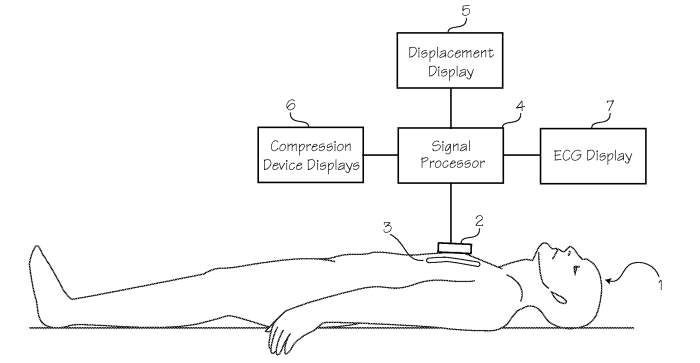 Chest compression feedback device monitors what